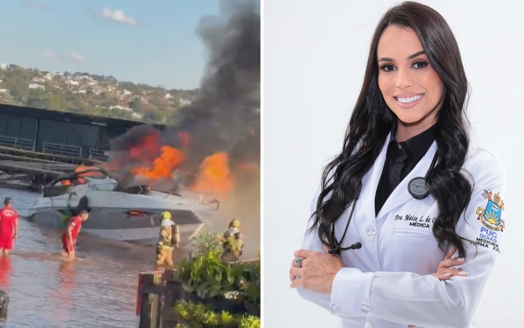 Médica que teve 50% do corpo queimado em explosão de lancha agradece nova chance: “O que importa é estar viva"
