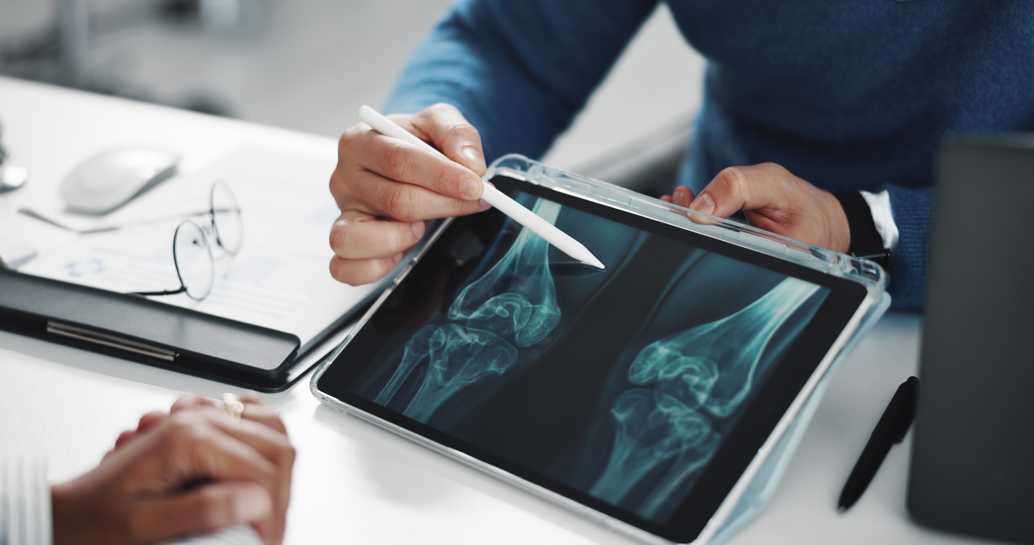 Osteoporose: entenda os fatores de risco e saiba como prevenir a doença que enfraquece os ossos