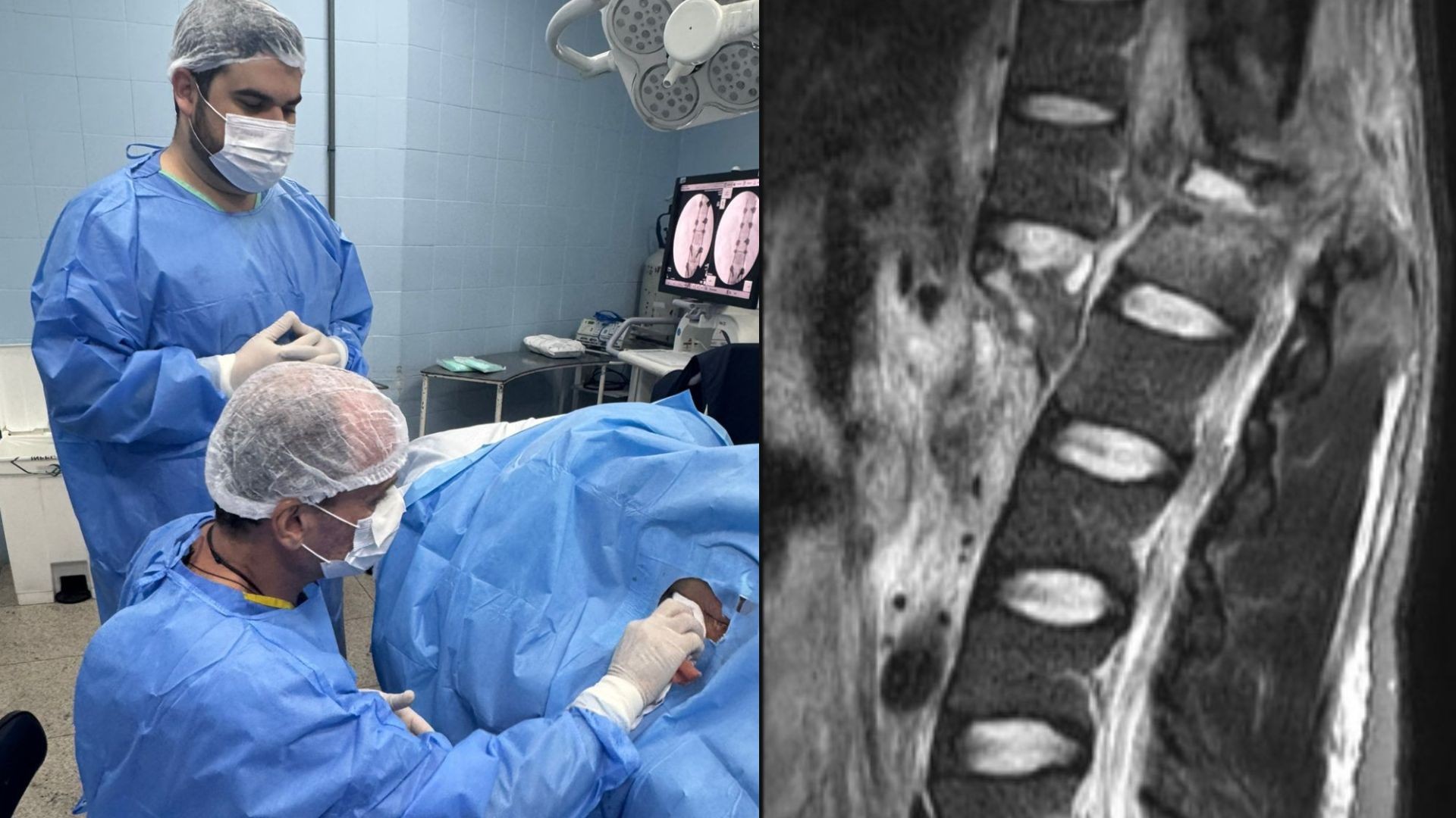 Cinco pacientes e janela de 48 horas: como será a corrida para aplicar droga experimental em vítimas de lesão na medula