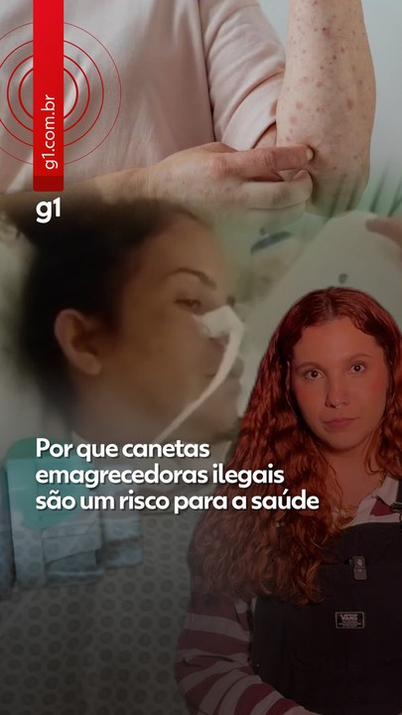 Veja quais canetas para perda de peso estão disponíveis e são autorizadas pela Anvisa no Brasil