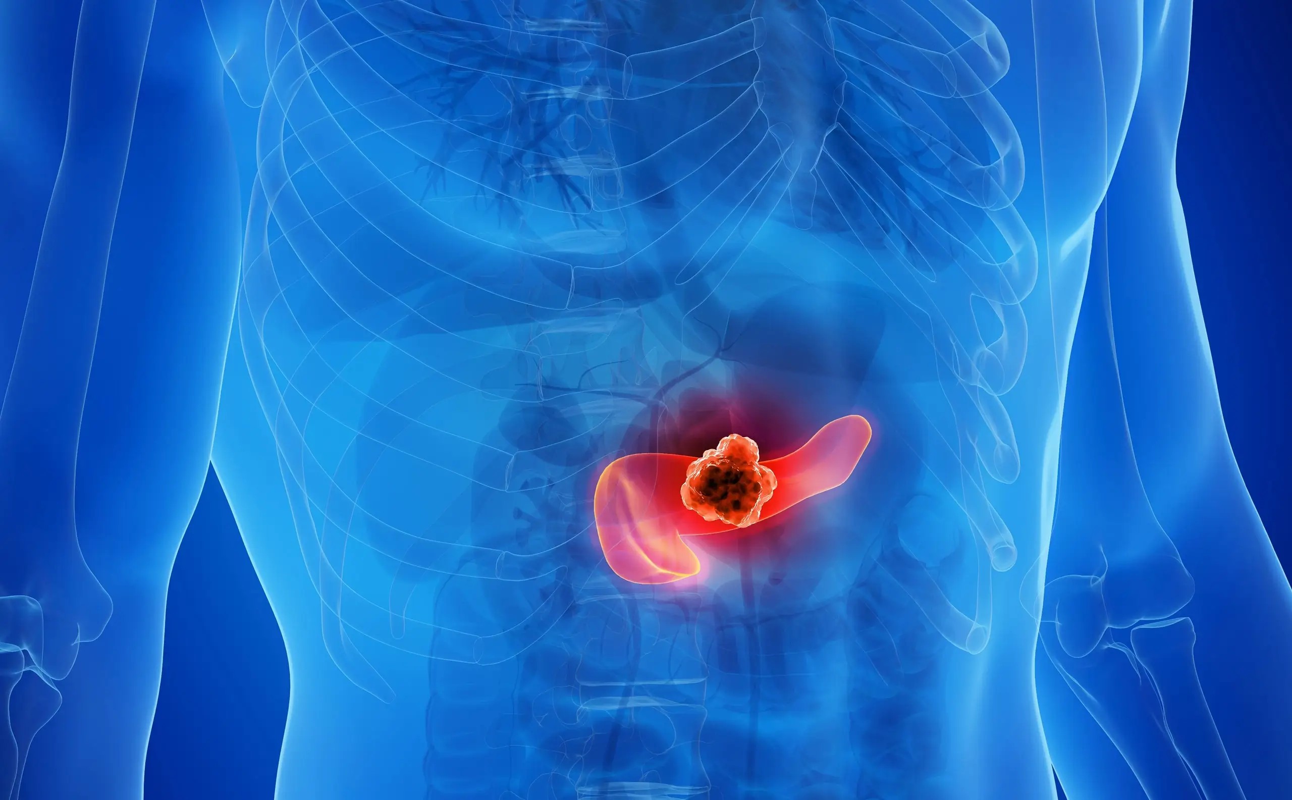 Cientistas usam combinação tripla de medicamentos e eliminam câncer de pâncreas em testes com animais