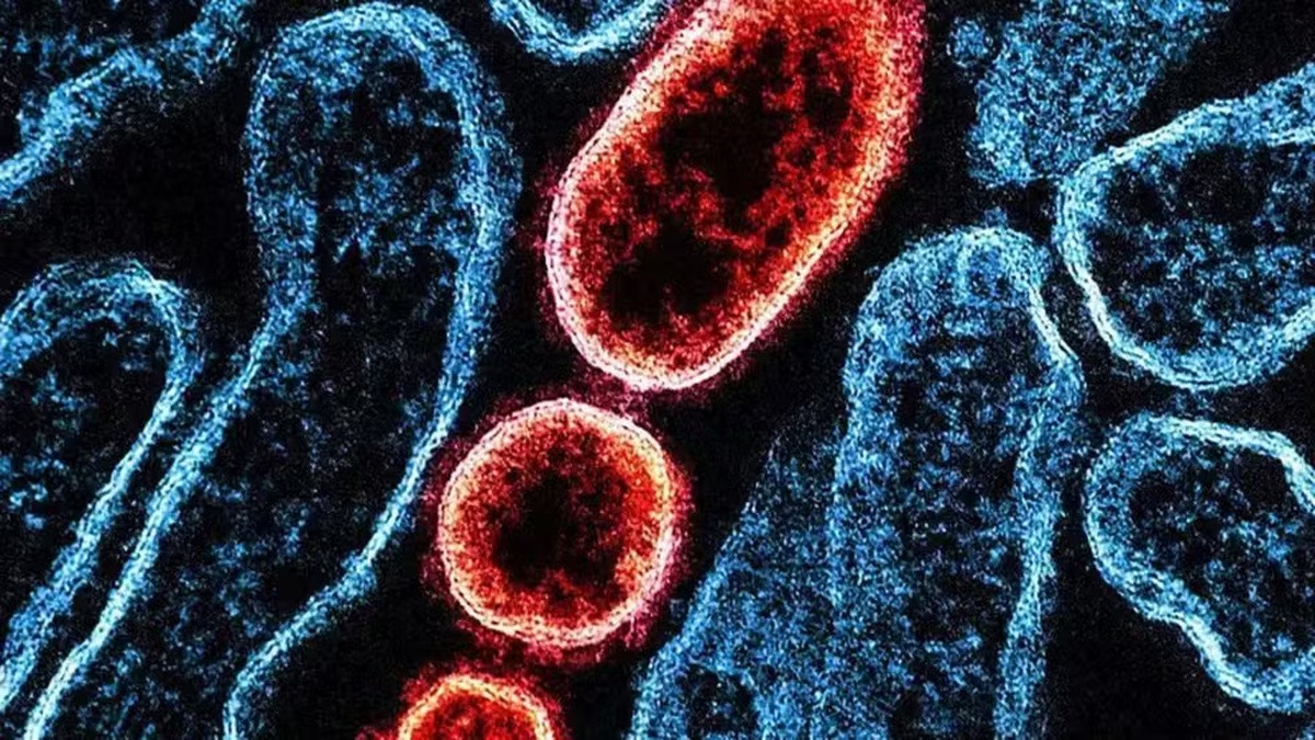 Nipah: vírus volta a preocupar saúde global após casos na Índia, mas sem cenário de novo surto