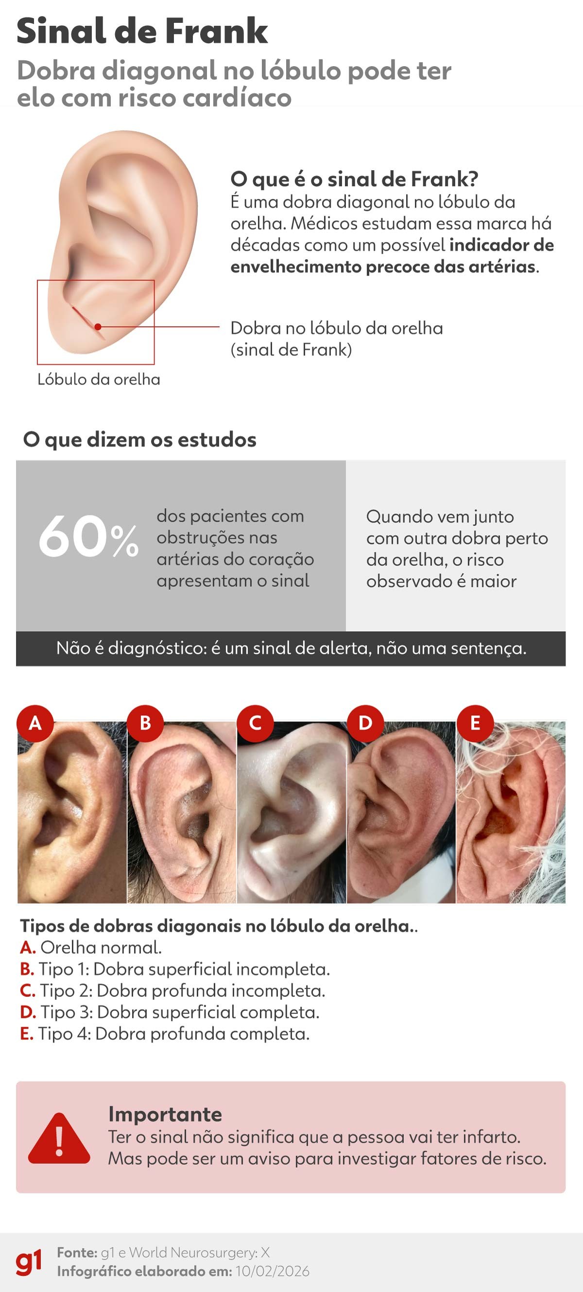 Dobra na orelha: o que fazer se você tem o sinal de Frank e quais os riscos de problema no coração