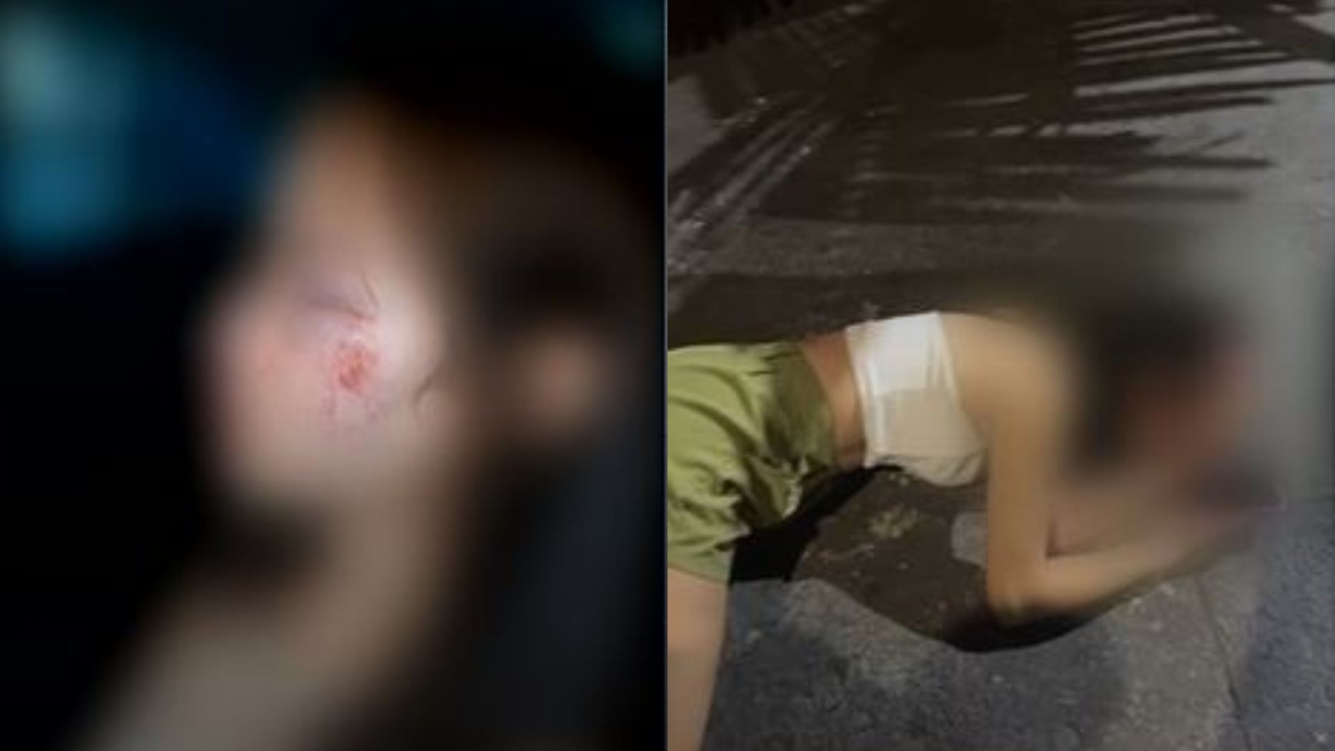 Mulher agredida na saída de boate diz que foi levada para beco após ter cloro jogado no rosto: 'Me bateram lá'