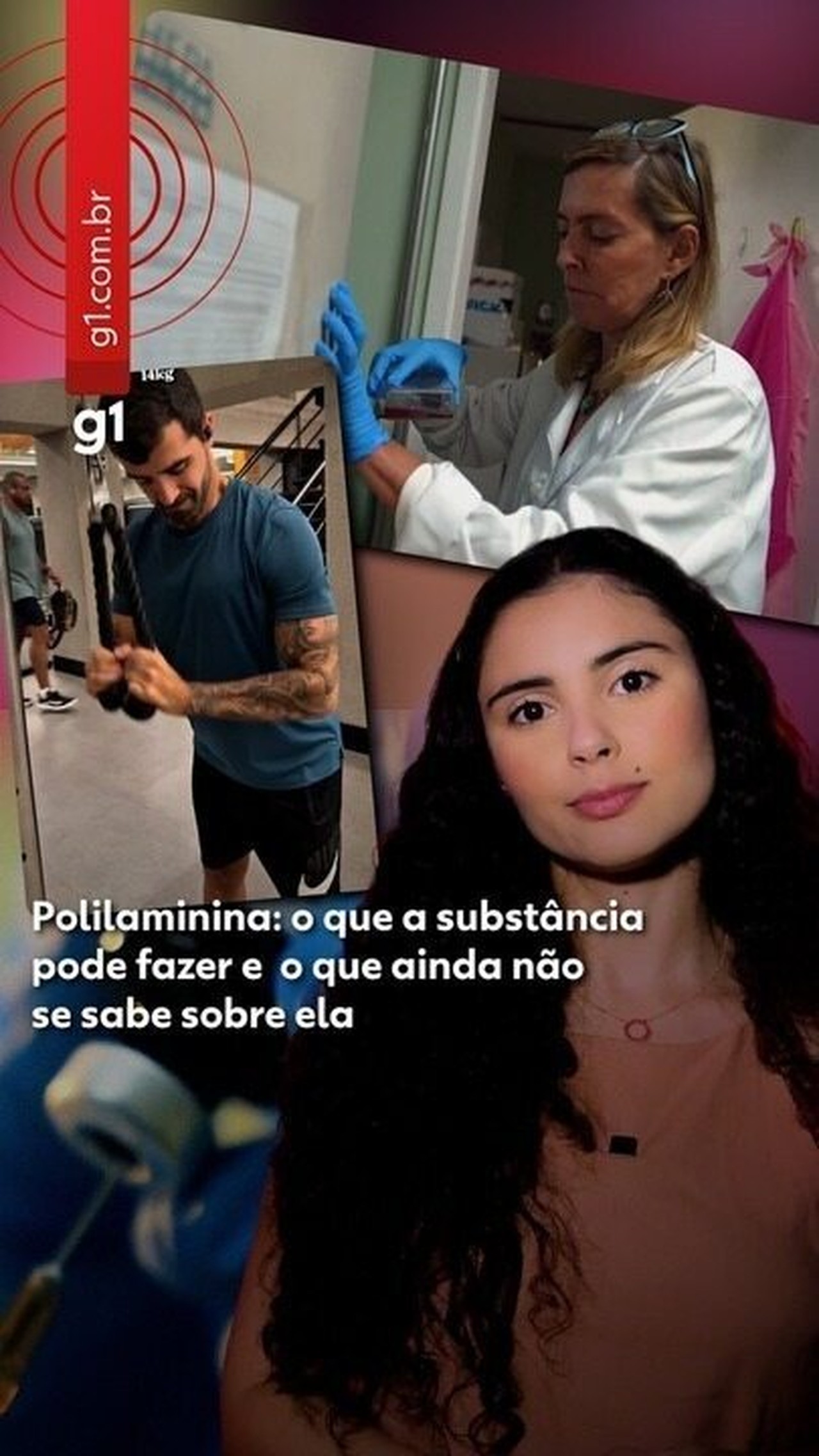 Polilaminina ainda não é remédio: especialistas alertam contra 'hype' nas redes