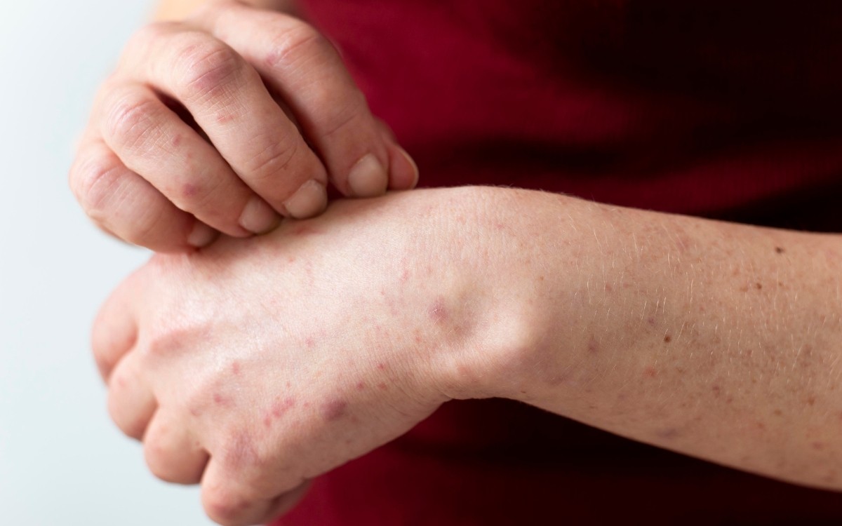 Cientistas descobrem que sistema imune ‘rouba’ DNA de células que estão morrendo