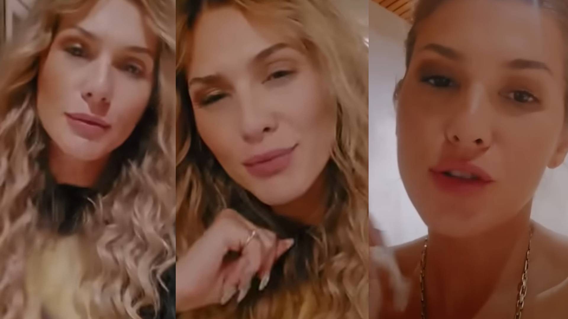 Neuralgia do trigêmeo, 'a pior dor do mundo': entenda a condição da apresentadora Lívia Andrade