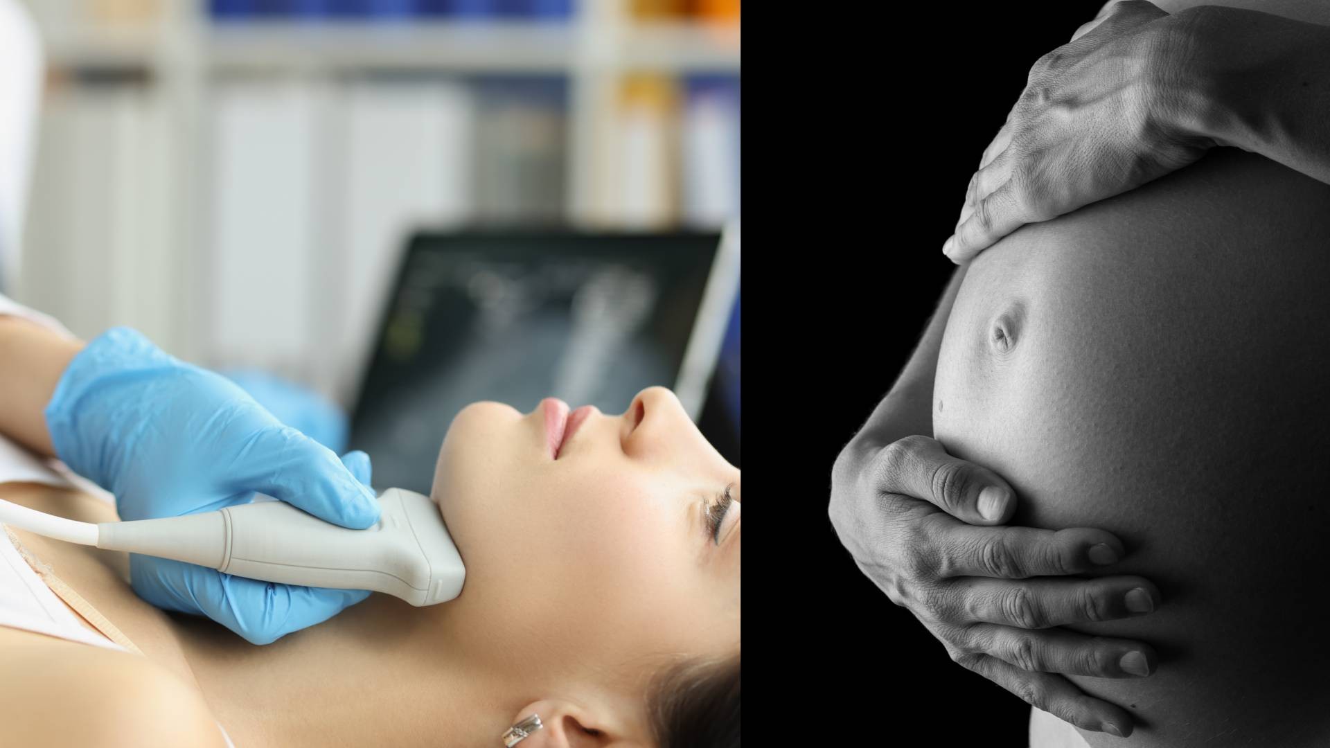 Autismo: estudo liga hipotireoidismo não tratado ao longo da gestação a risco maior para o bebê