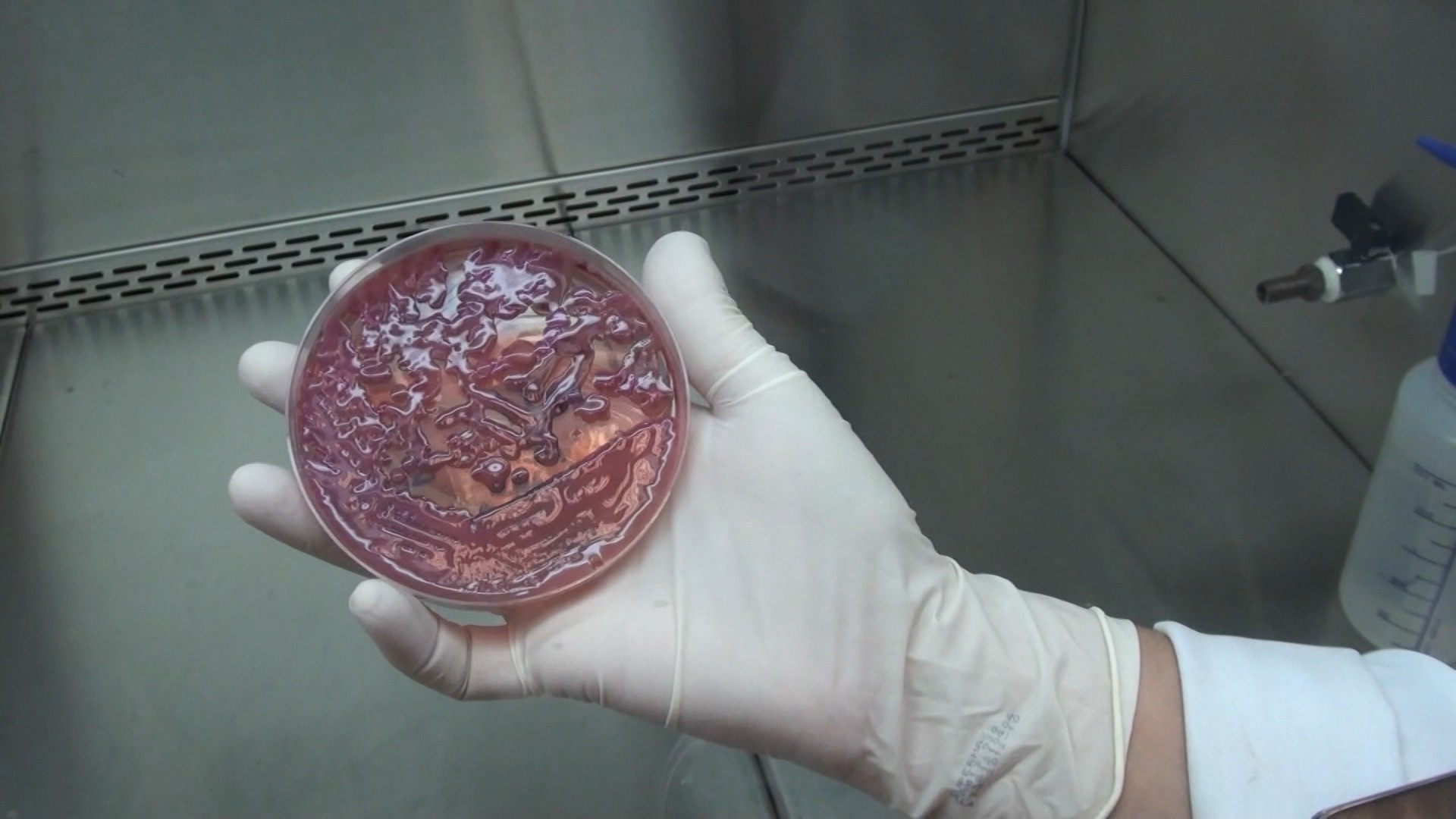 KPC: o que é a superbactéria resistente a antibióticos que levou hospital a esvaziar UTI