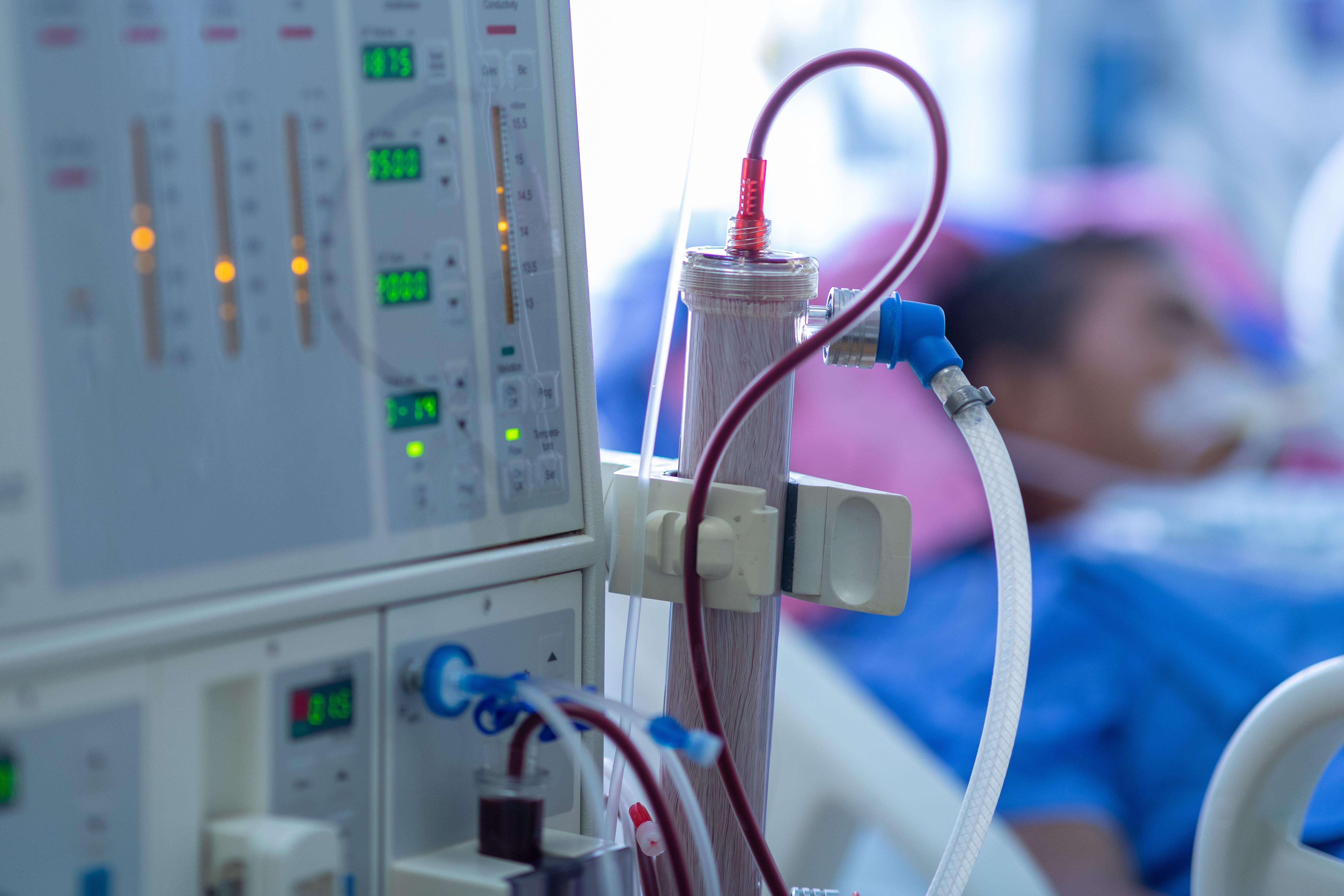 TCU abre investigação sobre atrasos em repasses para diálise no SUS; clínicas alertam para risco a pacientes