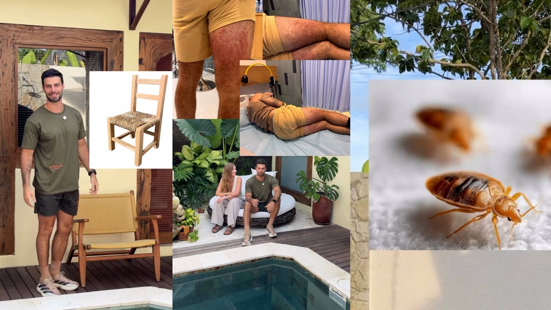 Ator Lucas Malvacini relata susto em Bali após reação alérgica a inseto; saiba como prevenir e tratar