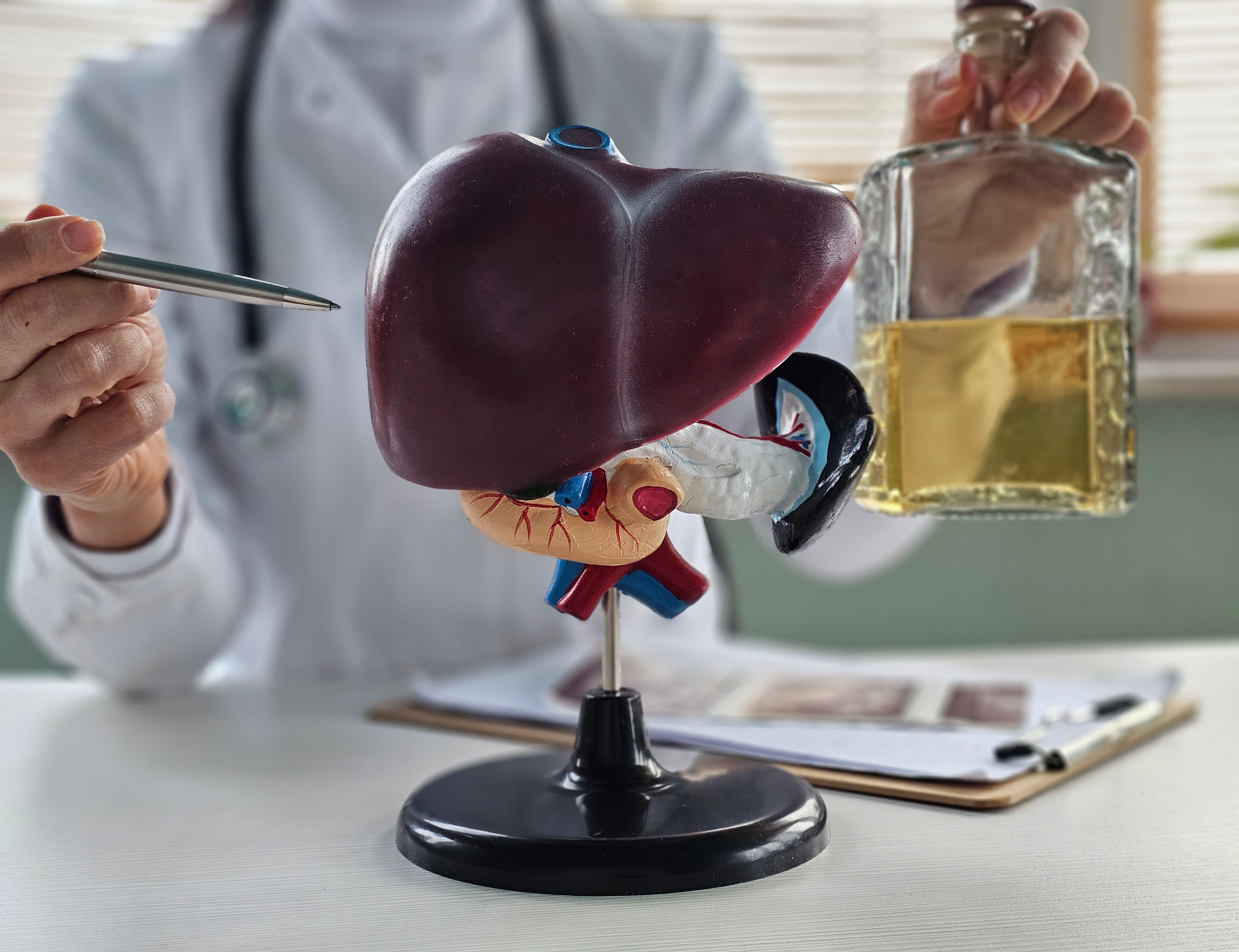 Beber muito álcool de vez em quando pode triplicar o risco de danos ao fígado em um terço da população, aponta estudo
