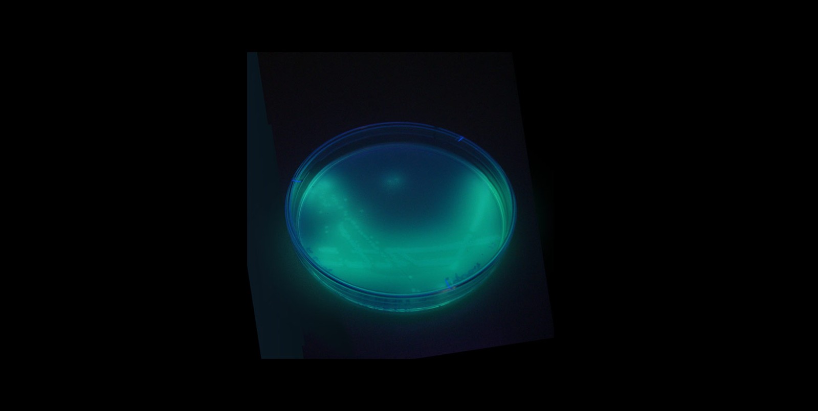 Bactéria Pseudomonas aeruginosa foi identificada em mais de 100 lotes de produtos Ypê em inspeção de abril, diz Anvisa