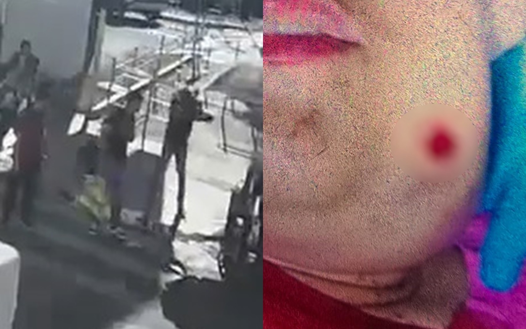‘O que foi que você está rindo da minha cara?’, disse homem antes de balear jovem autista no rosto, relata mãe