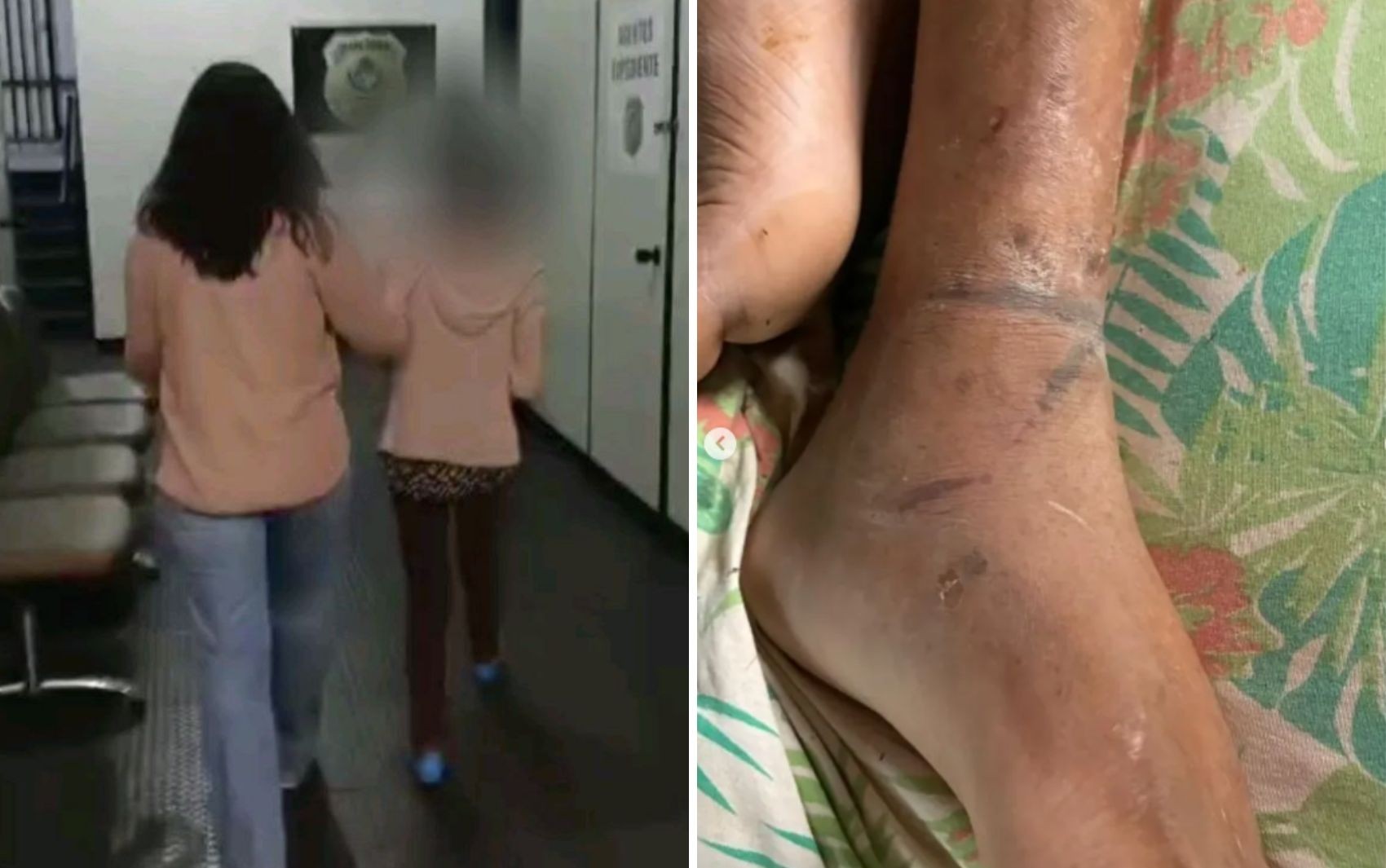 Filho acorrentado pela mãe que ficou dias sem água e comida sofreu três AVCs, diz polícia