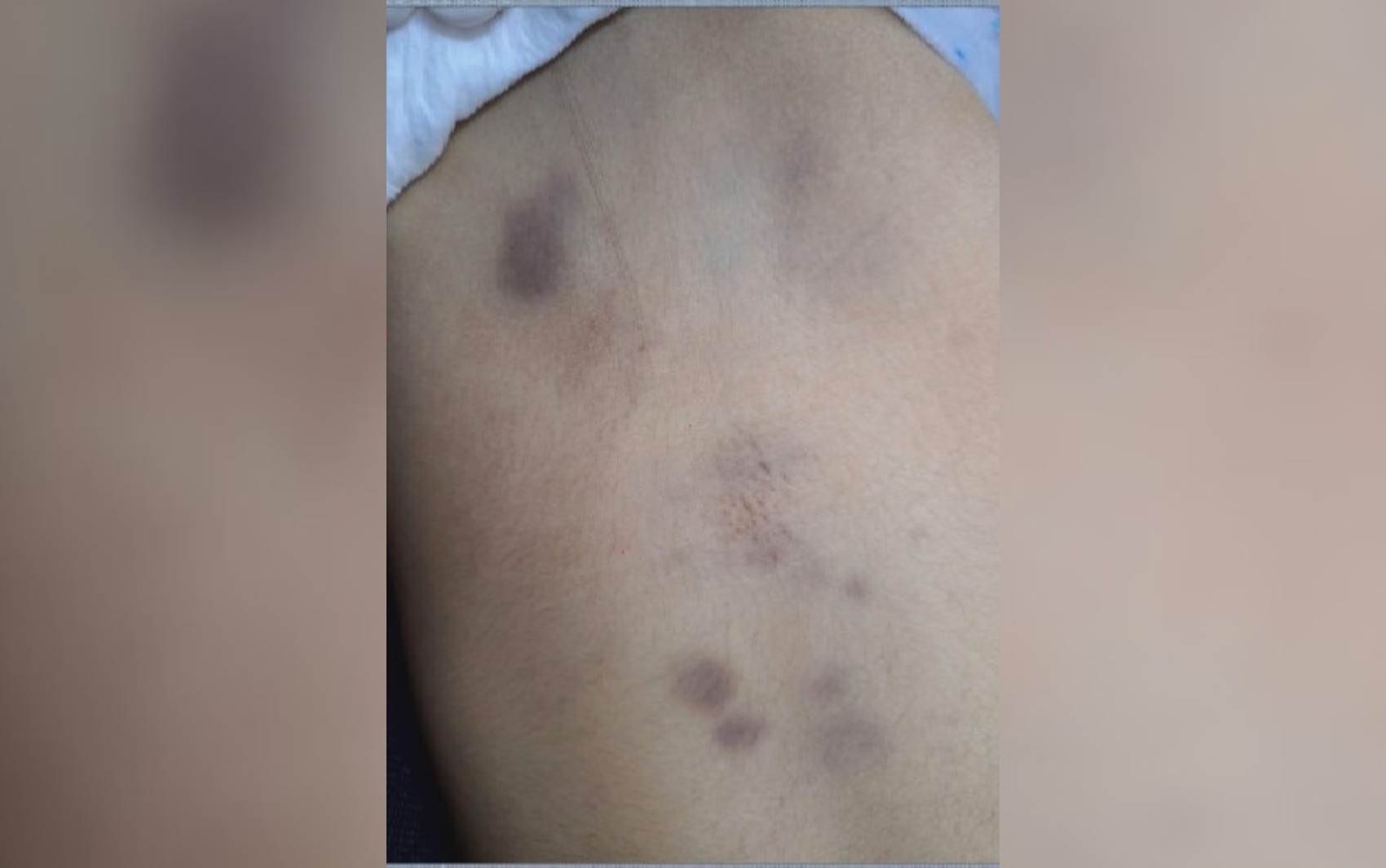 Casa foi lavada para tentar esconder sangue de menina morta após espancamento, diz delegado