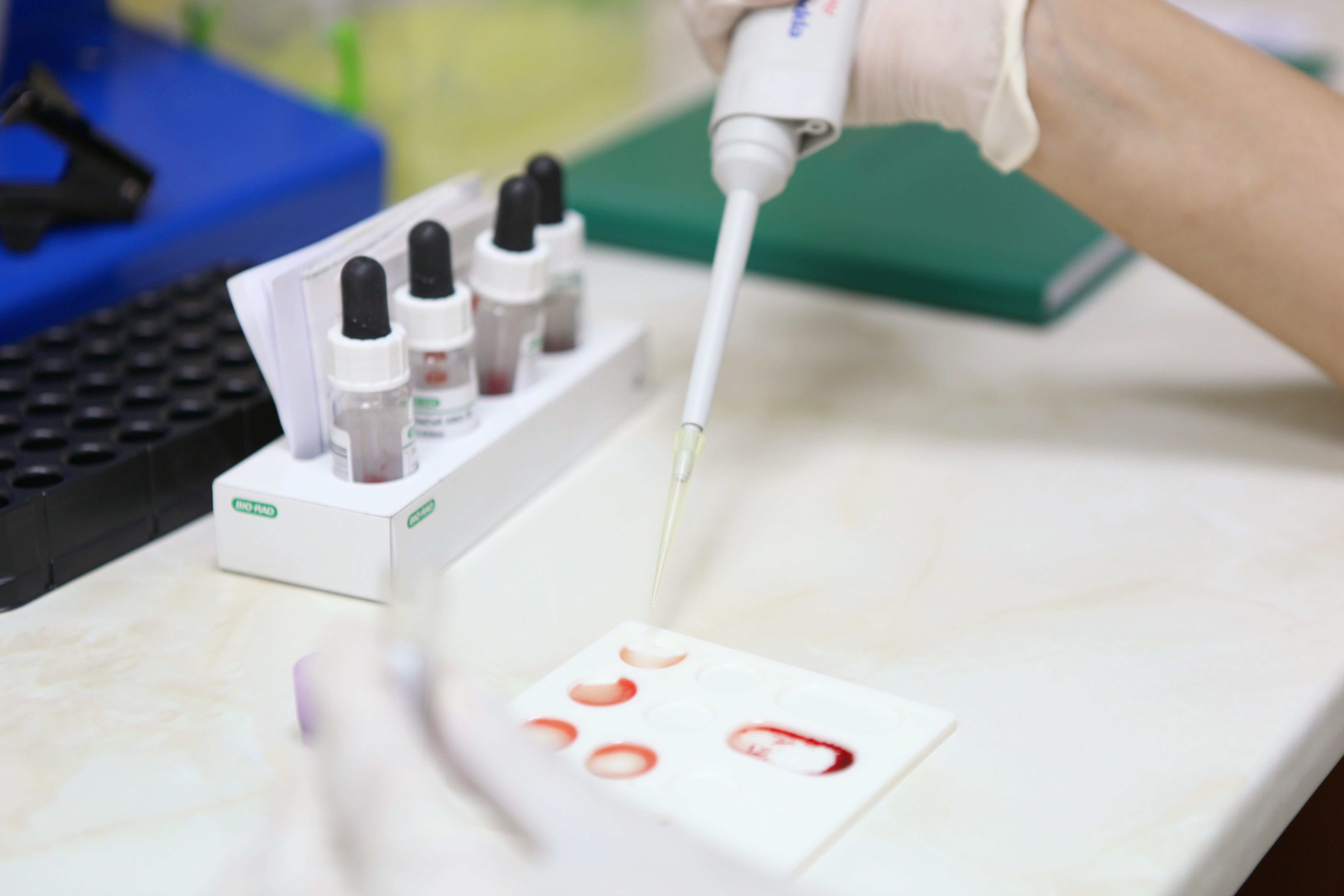 Como um estudo ‘negativo’ abriu portas para rastrear câncer com um exame de sangue