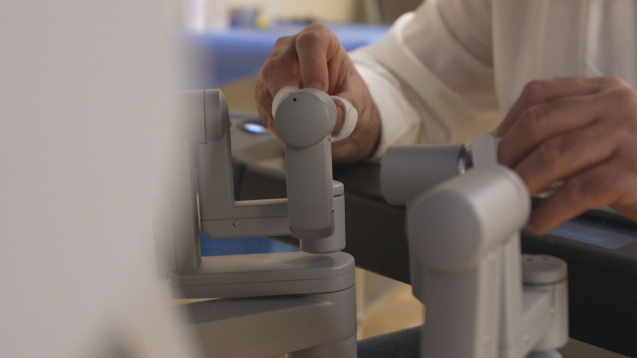 Transplante de rim entre vivos feito por robôs é realizado pela primeira vez na América Latina; veja detalhes