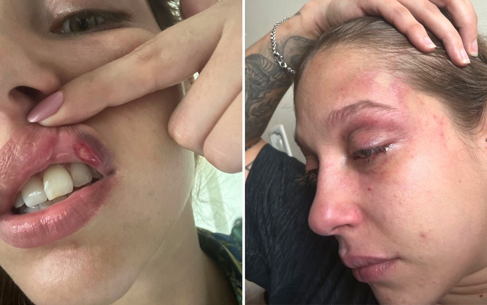 Jovem que denunciou ter sido espancada por empresário desabafa: ‘Ainda não me sinto segura’