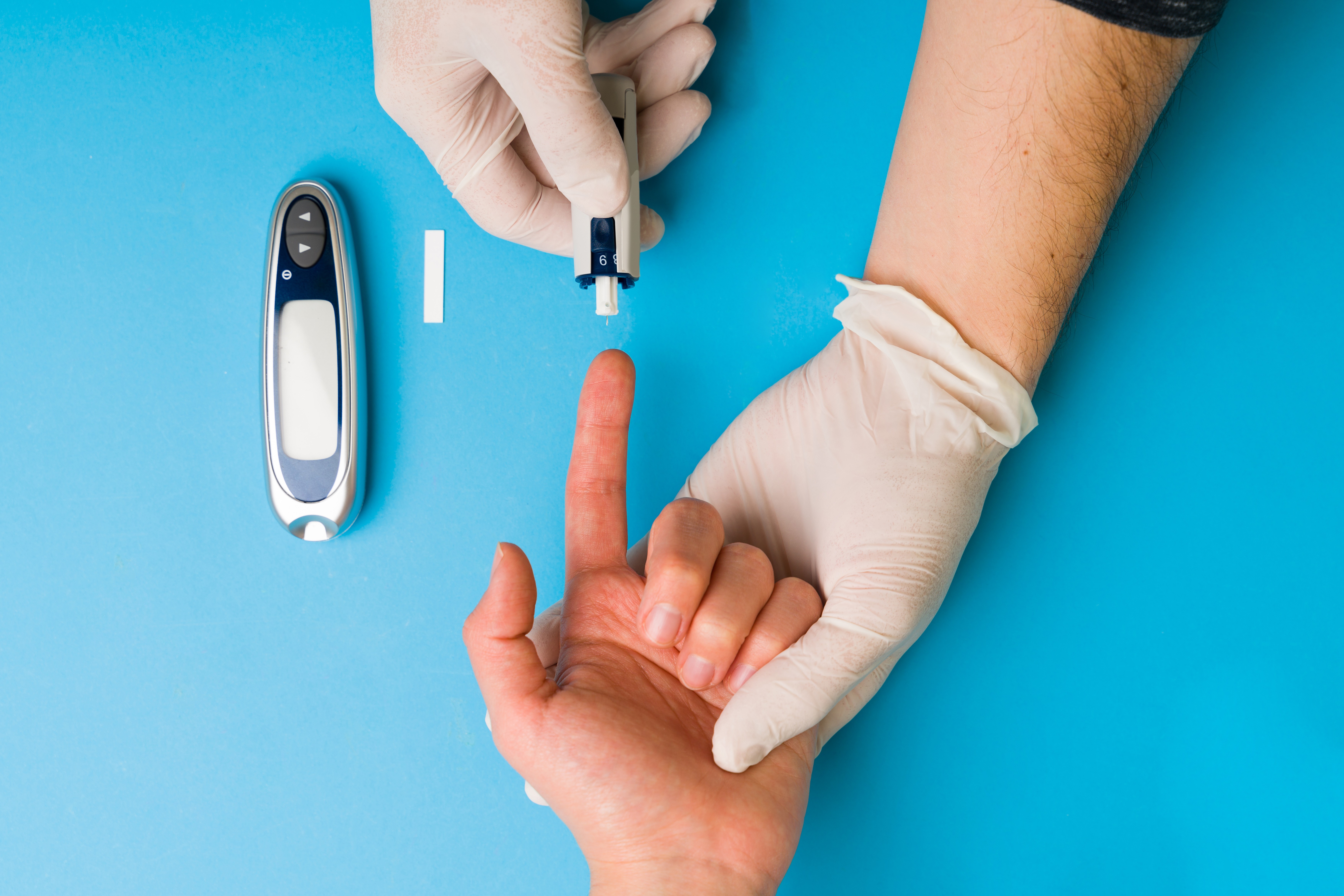 Cirurgia ‘gêmea’ da bariátrica trata diabetes tipo 2 e controla a doença em até 89% dos casos