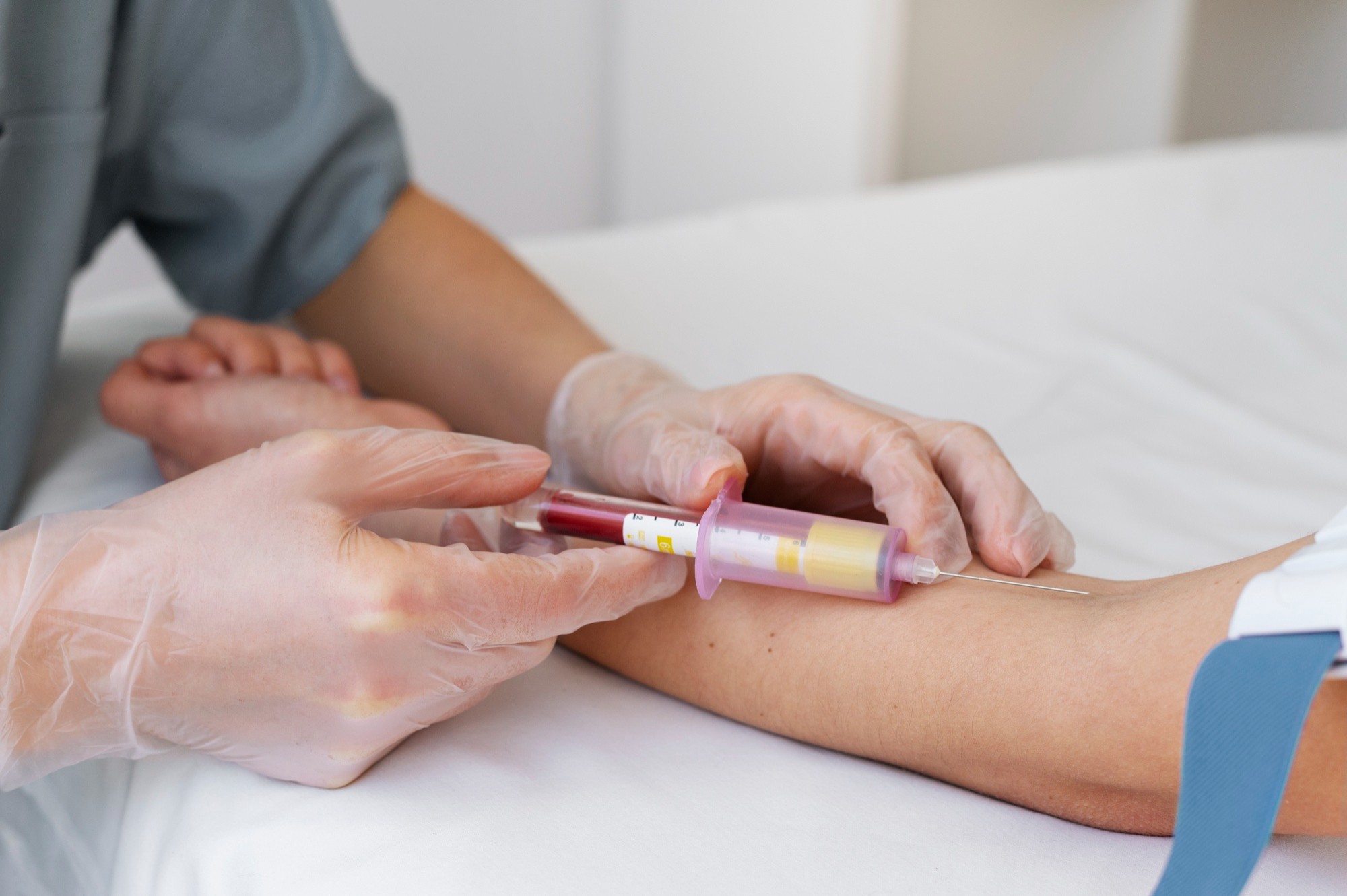 Como um 'simples' exame de sangue pode prever risco de câncer de pulmão até 5 anos antes do diagnóstico