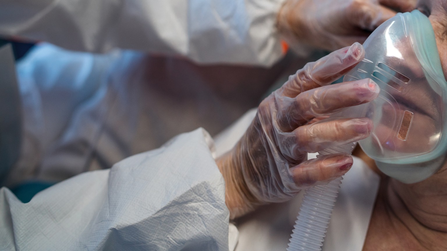 Vírus sincicial respiratório (VSR) impulsiona aumento de casos graves de síndrome respiratória no Brasil; proteção de vacina dura até três anos