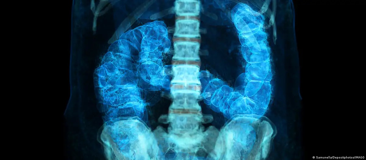 Câncer de intestino: maioria dos brasileiros desconhece exame que pode detectar precocemente doença, aponta pesquisa