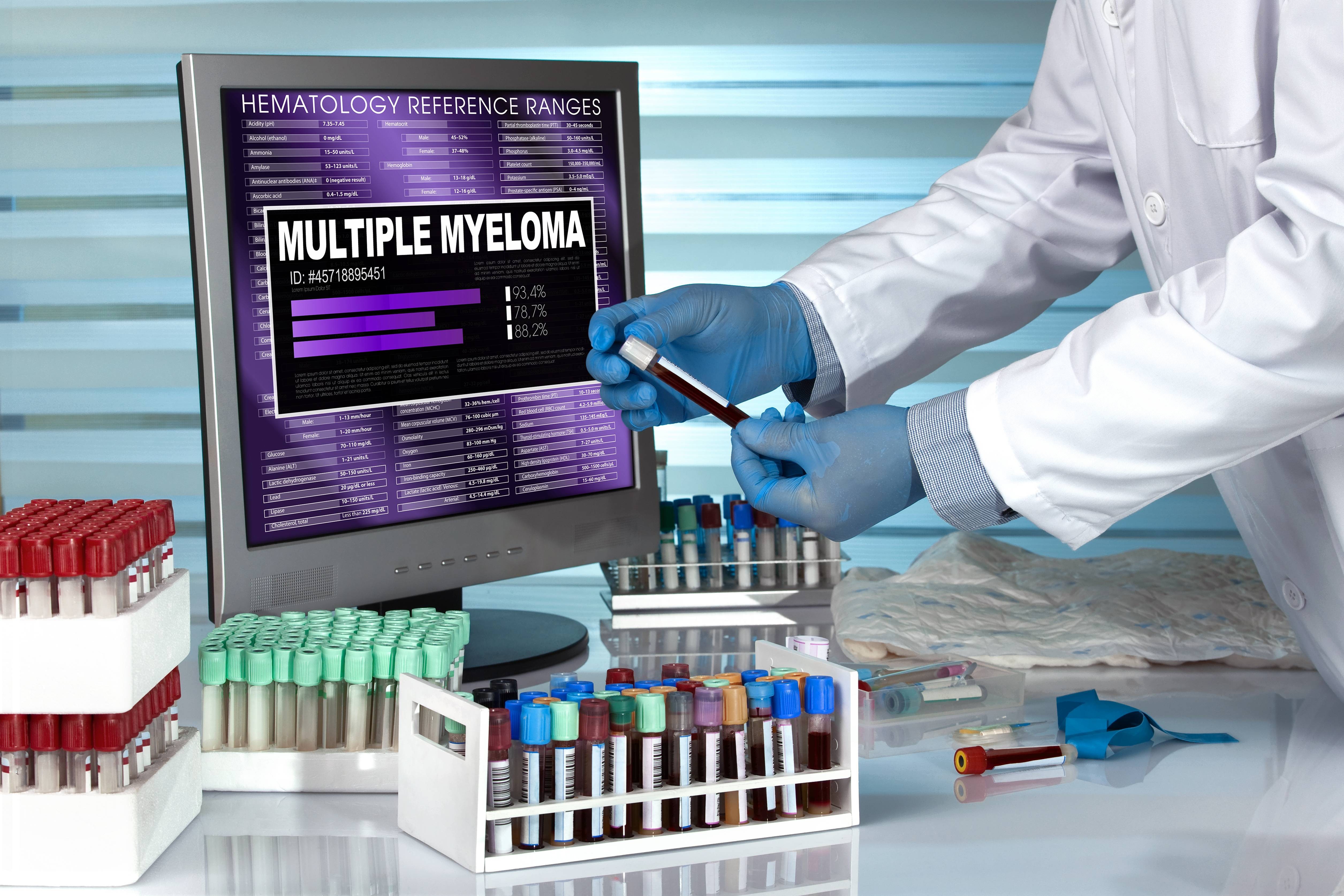 Com novos tratamentos, estudo propõe mudar critério para identificar pacientes com forma mais grave de mieloma múltiplo