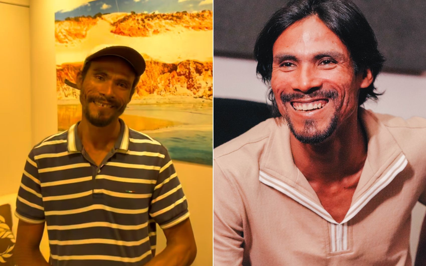 Veja antes e depois de cantor que vivia em situação de rua e fez sucesso cantando em bar