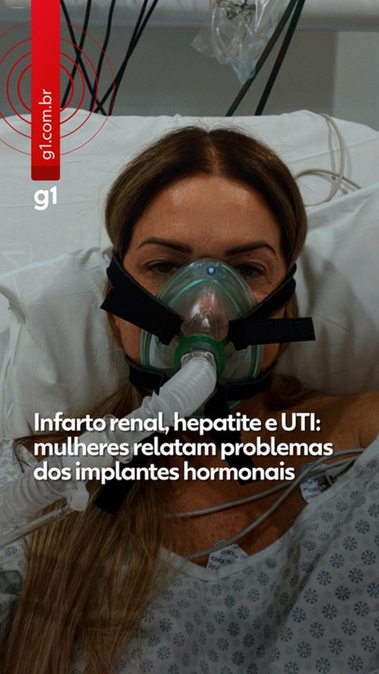 Notificações de efeitos adversos com testosterona sobem e Anvisa alerta sobre uso indevido em mulheres