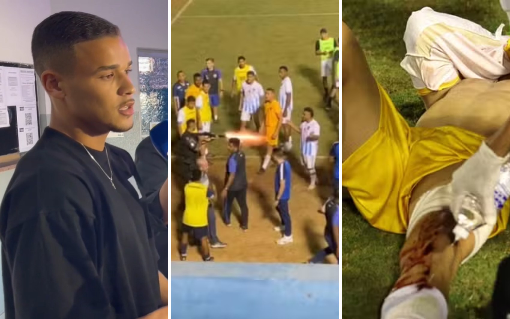 Goleiro atingido por tiro de bala de borracha de policial após jogo deve ser indenizado em cerca de R$ 100 mil; vídeo mostra tiro